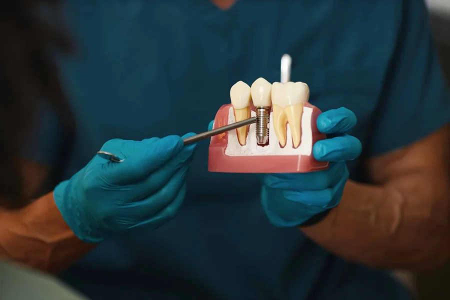 3 Signs You’re An Ideal Candidate For Dental Implants