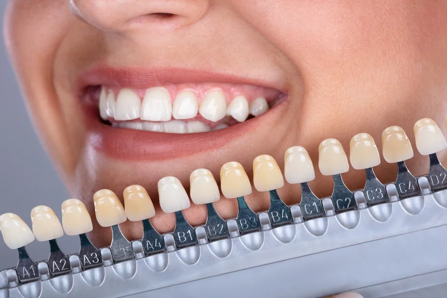 The Role Of Preventive Dentistry In Improving Smile Aesthetics Over Time