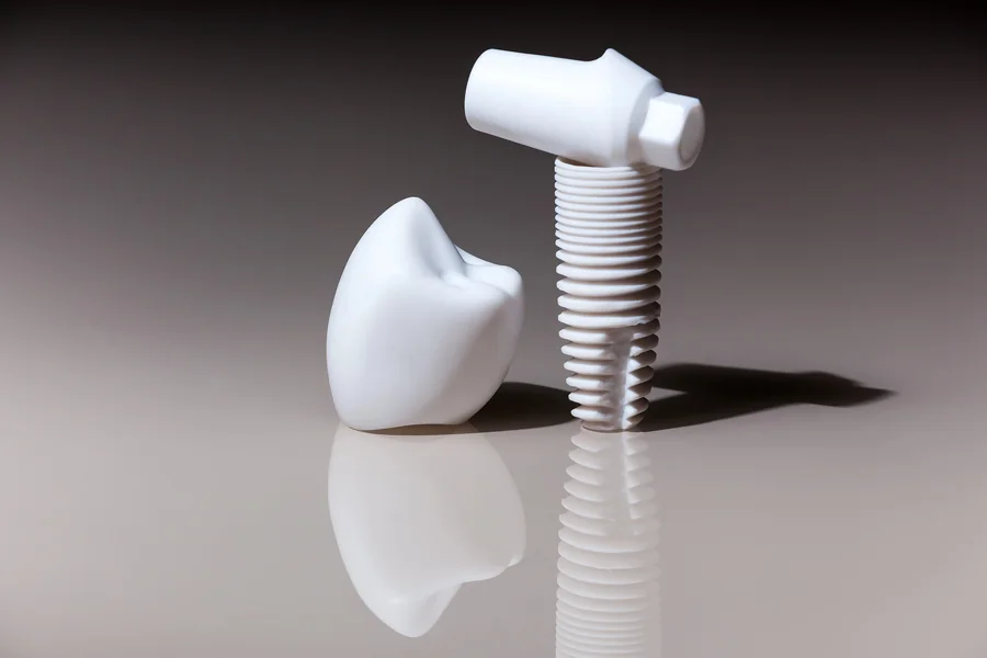 Dental Implants Singapore: Why Some Implants Heal Faster Than Others